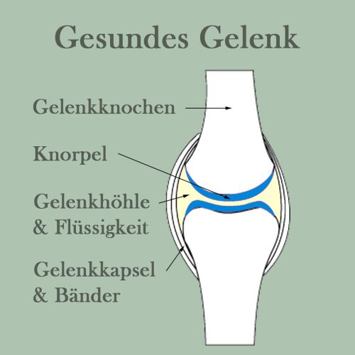 Gelenk_Arthrose1-1